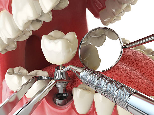 Best Urgent Tooth Repair  in Biggs, CA